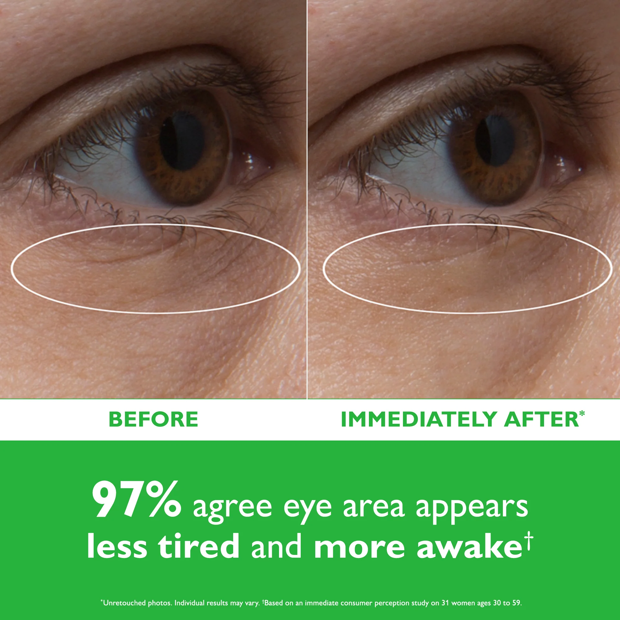 Cucumber De-Tox Hydra-Gel Eye Patches|30 pairs / 60 patches - Image 2