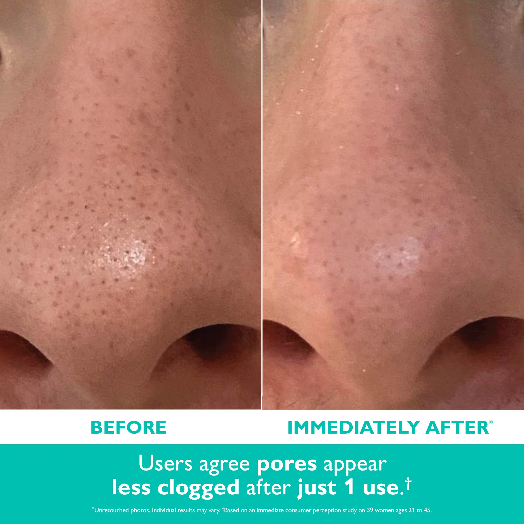 Even Smoother™ Microdermabrasion Exfoliating Pore Purifier|50 ml / 1.7 fl oz - Image 2