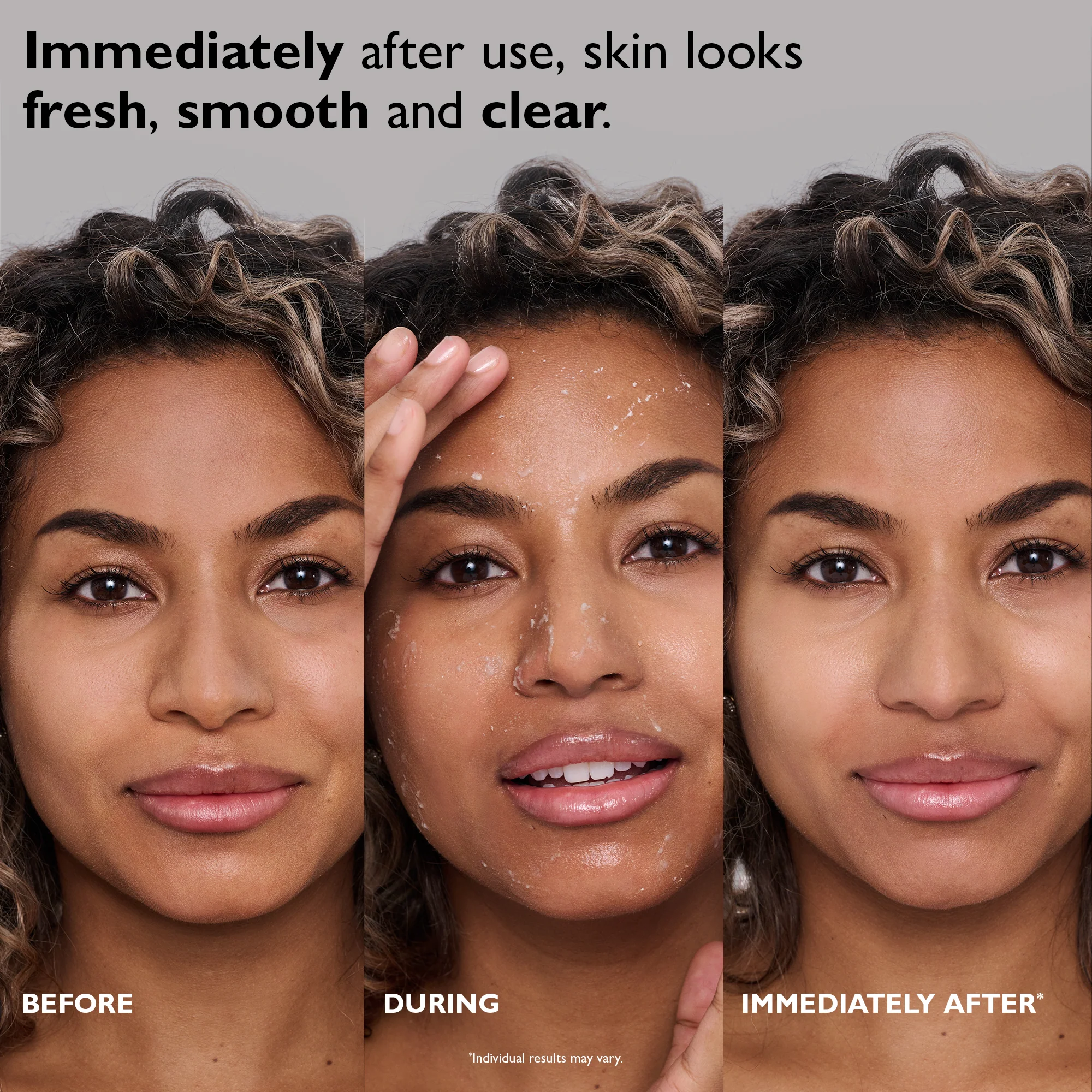 FIRMx Peeling Gel|3.4 fl oz - Image 2