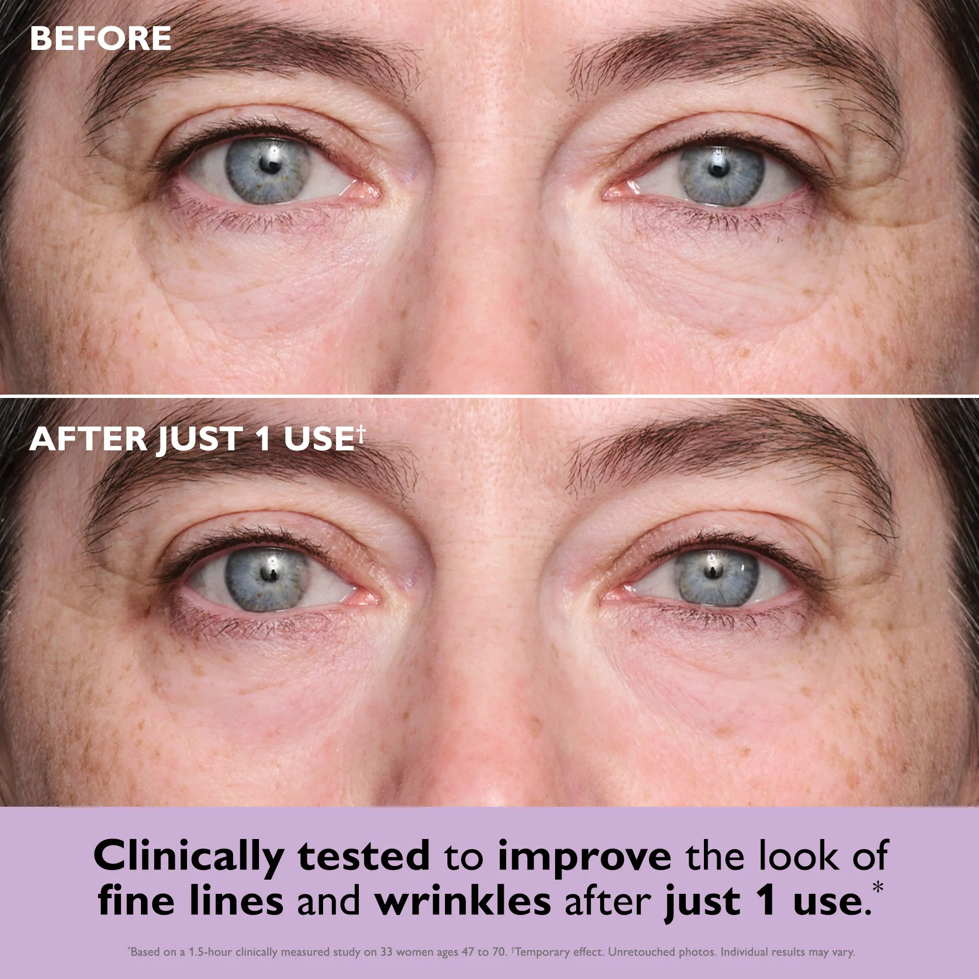 Instant FIRMx® Collagen Tightening Eye Patches - Image 2