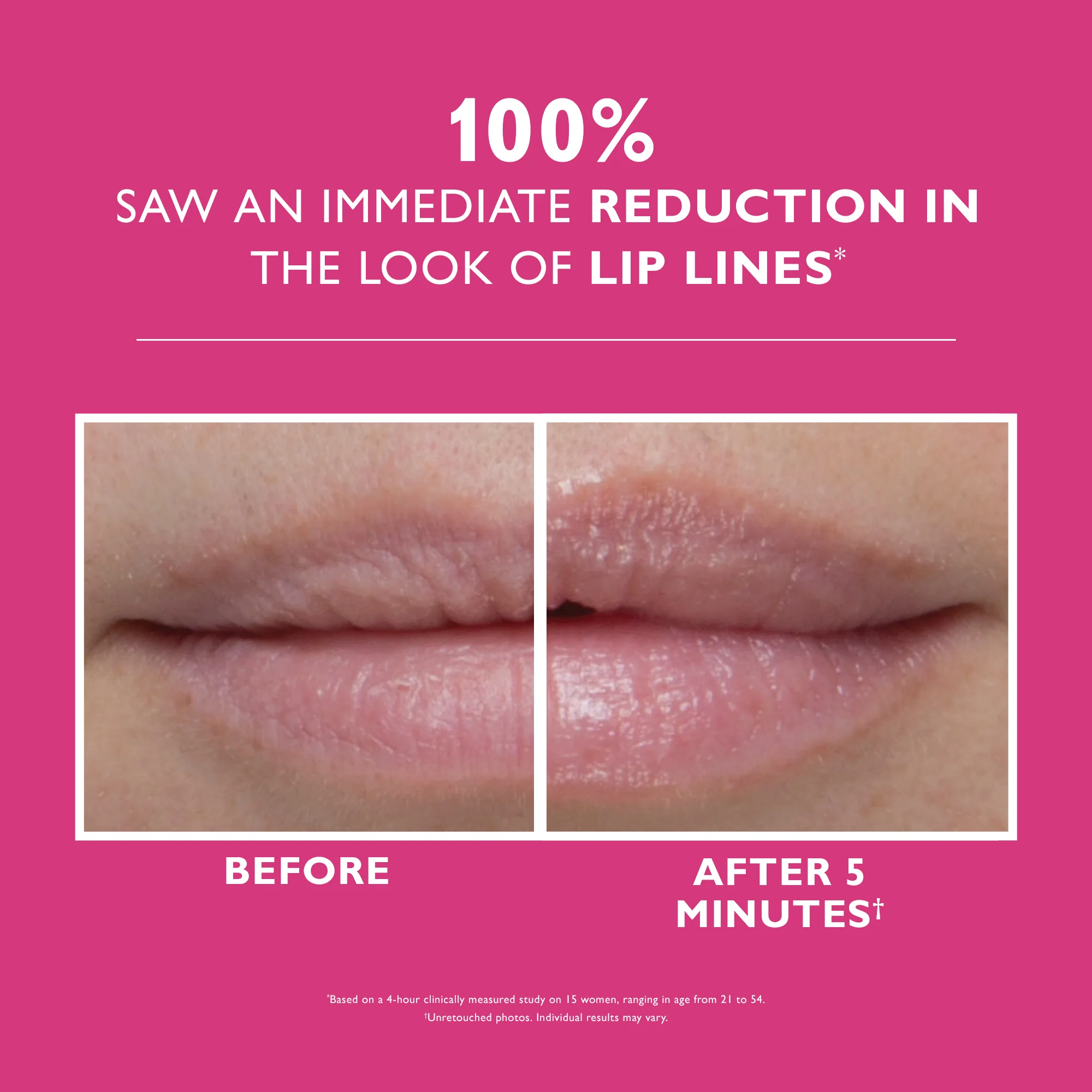 Instant FIRMx Lip Filler|10 ml / 0.3 fl oz - Image 2