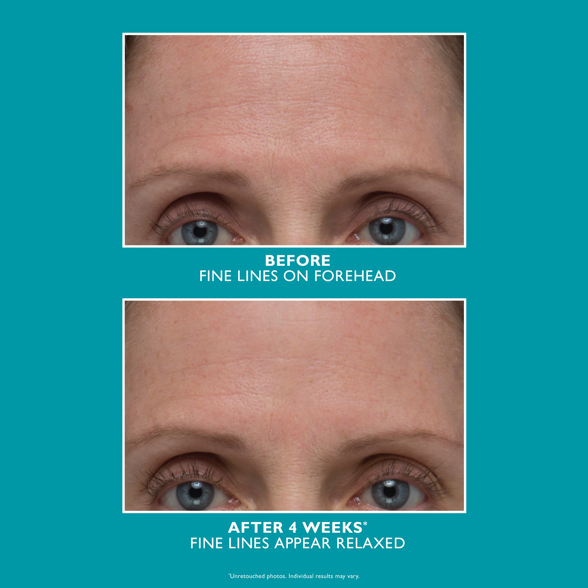 Peptide Skinjection Amplified Wrinkle-Fix Serum|30 ml / 1 fl oz - Image 3