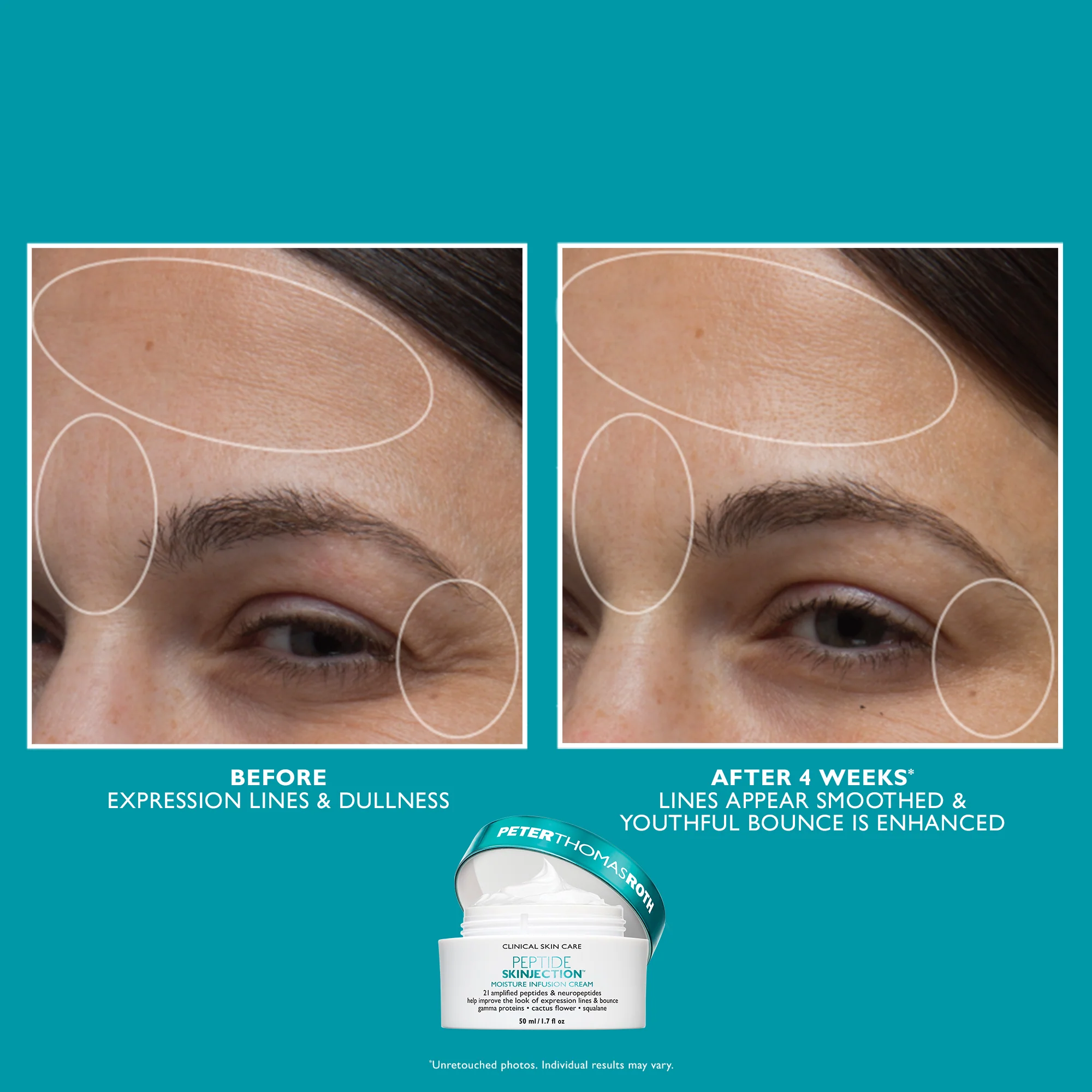 Full-Size Peptide Skinjection™ 2-Piece Kit Face & Eye Kit - Image 5
