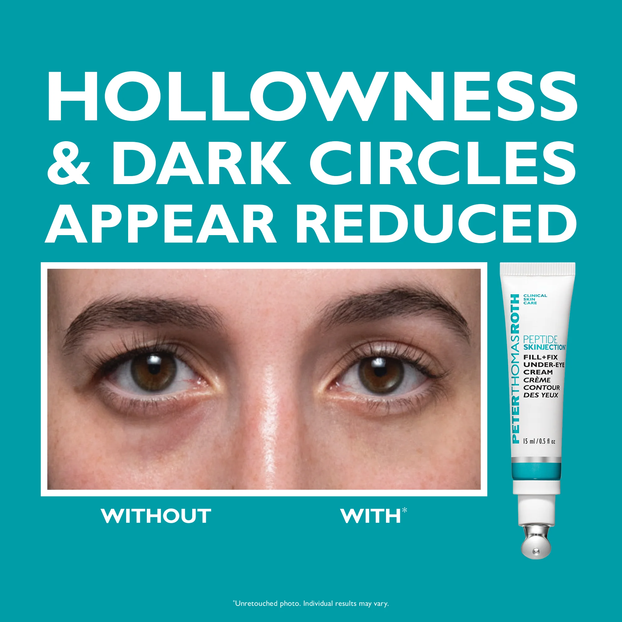 Full-Size Peptide Skinjection™ 2-Piece Kit Face & Eye Kit - Image 6