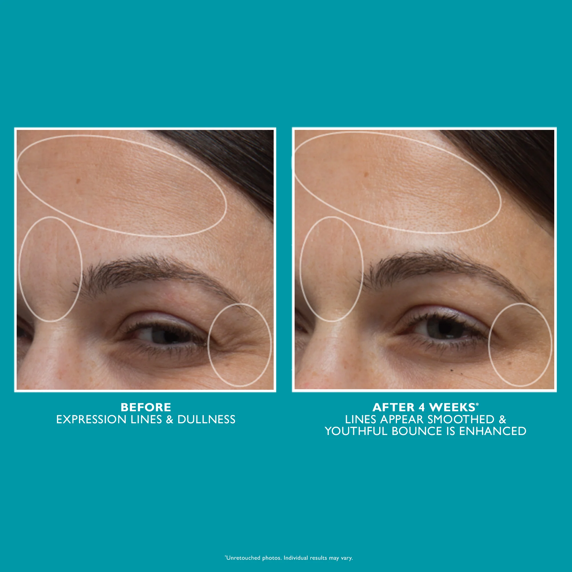Peptide Skinjection Moisture Infusion Cream | 50ml - Image 6