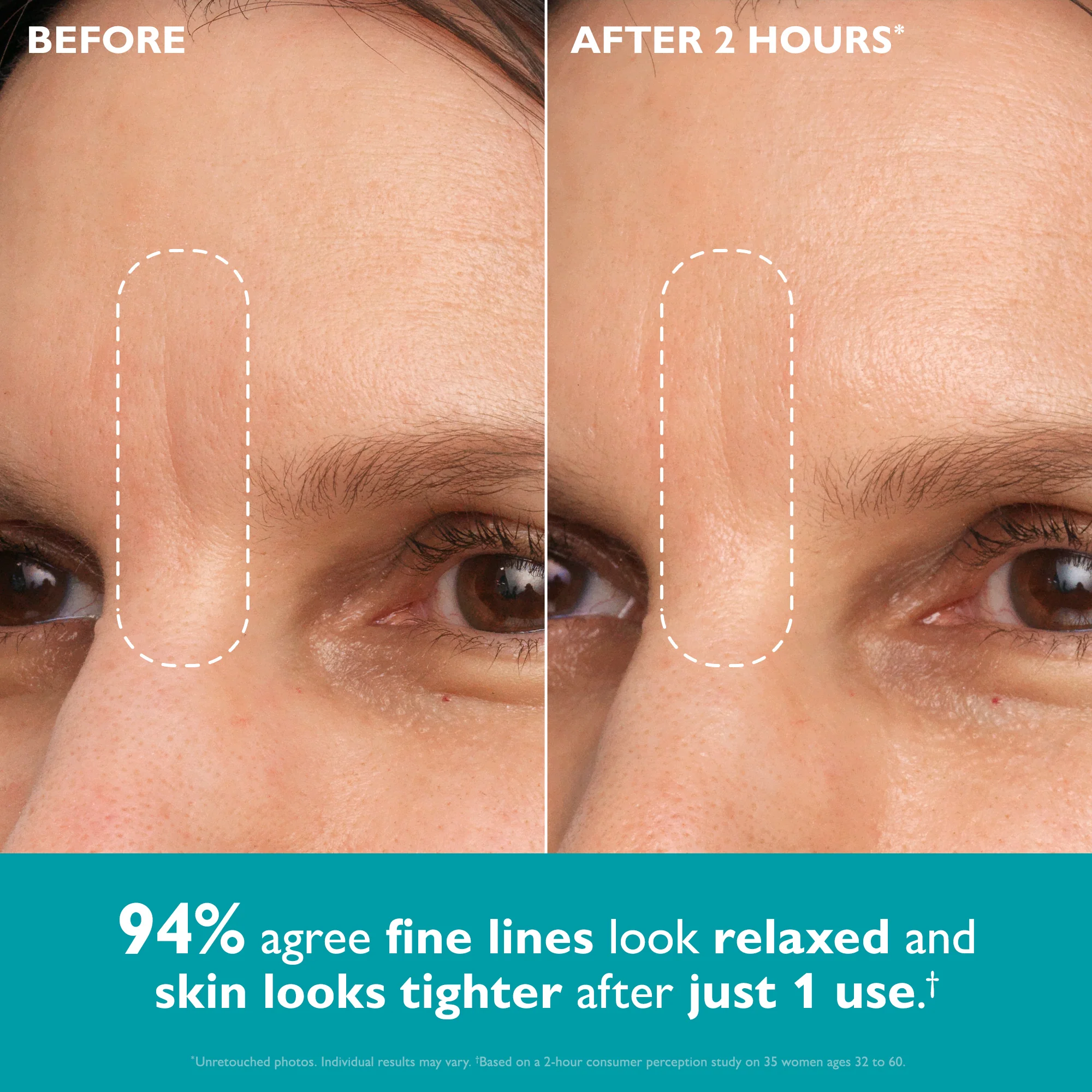 Peptide Skinjection Peptide Infused Face + Eye Tape - Image 2
