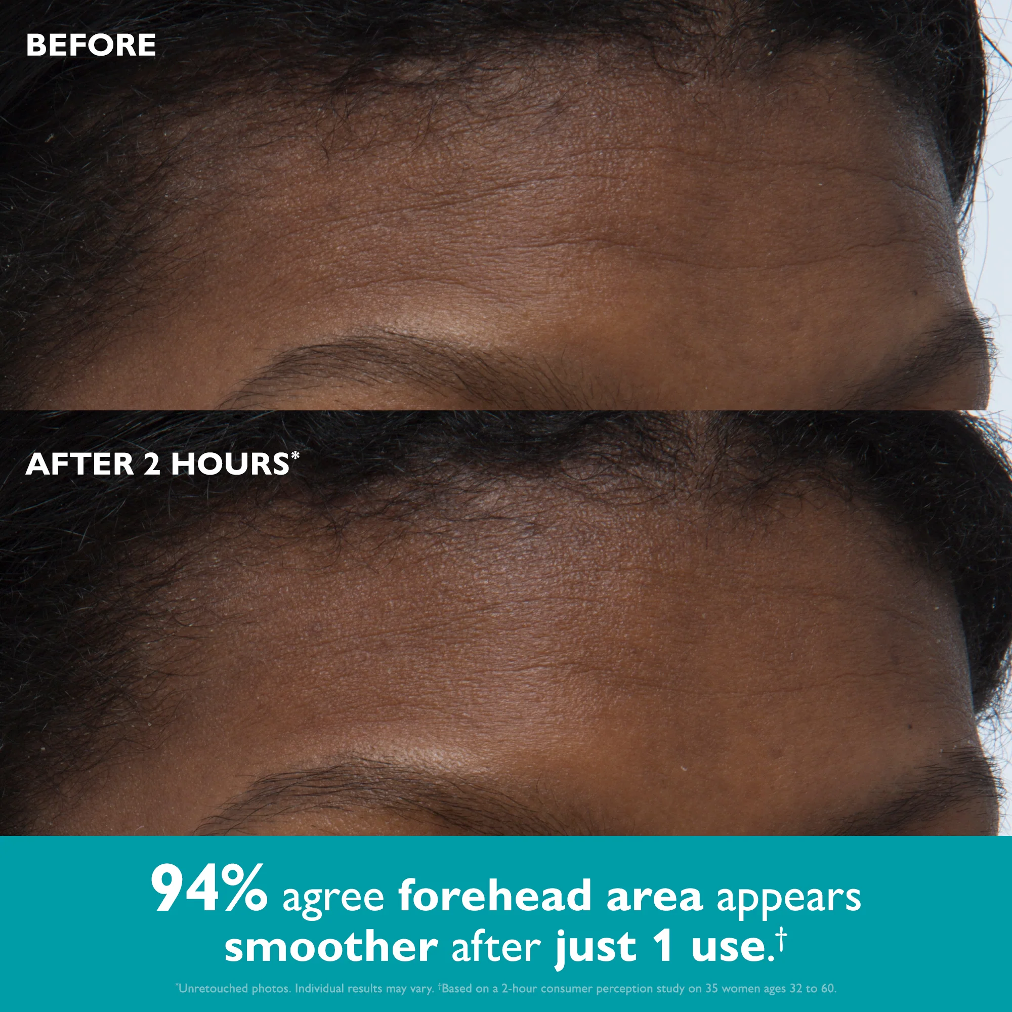 Peptide Skinjection Peptide Infused Face + Eye Tape - Image 4