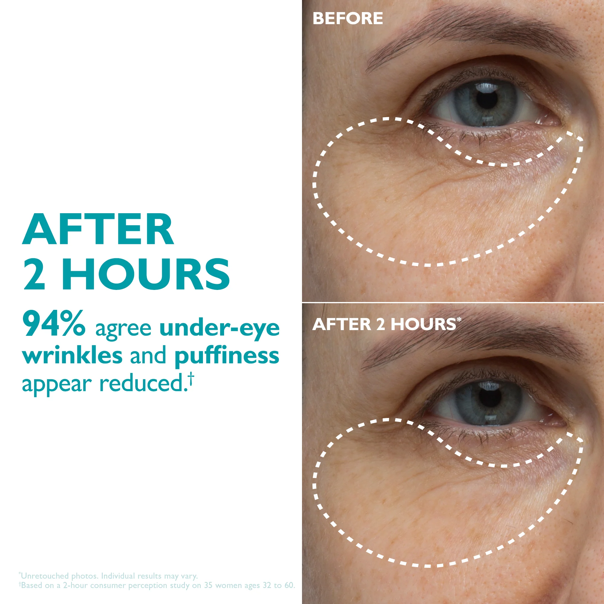Peptide Skinjection Peptide Infused Face + Eye Tape - Image 6