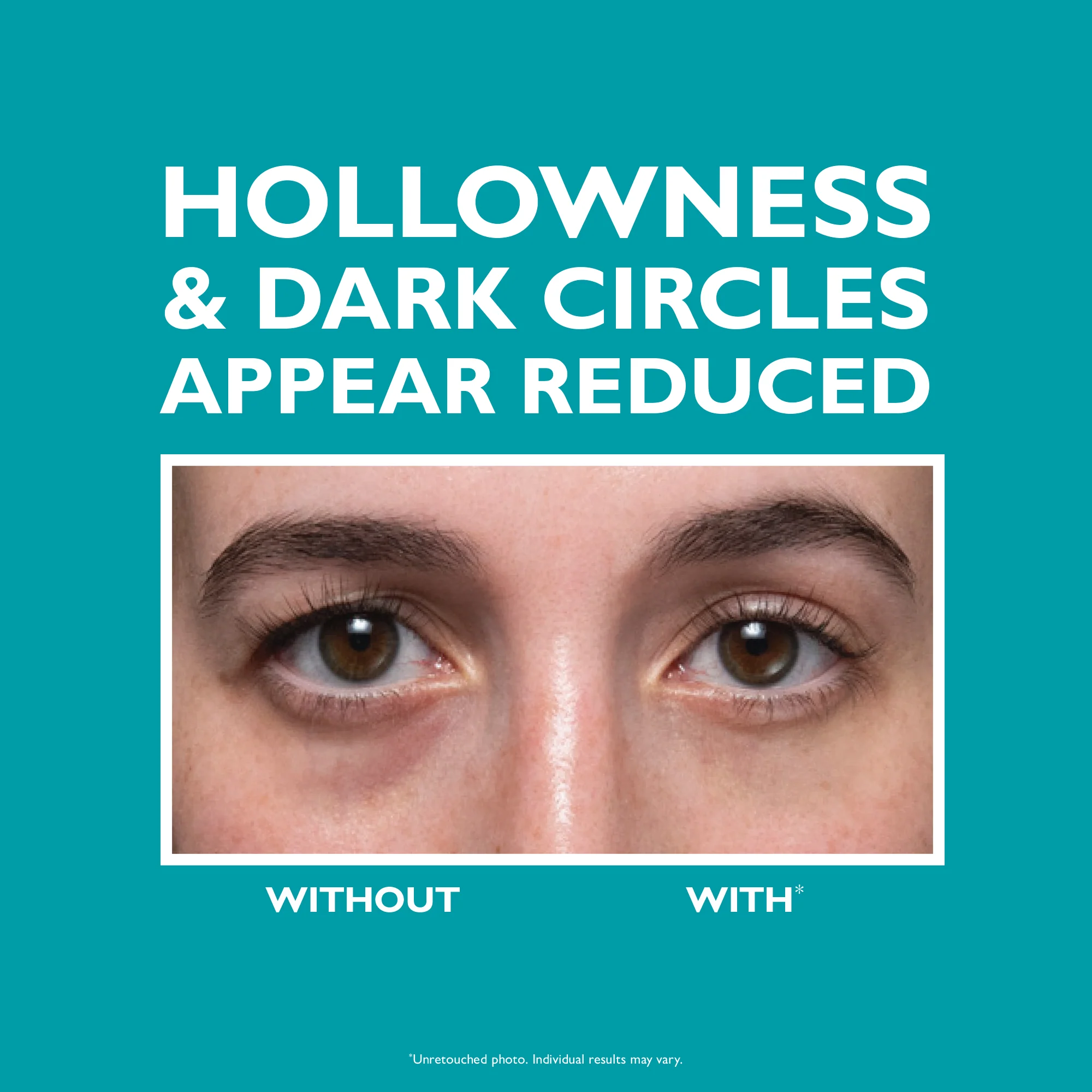 Peptide Skinjection™ Fill + Fix Under-Eye Cream - Image 2