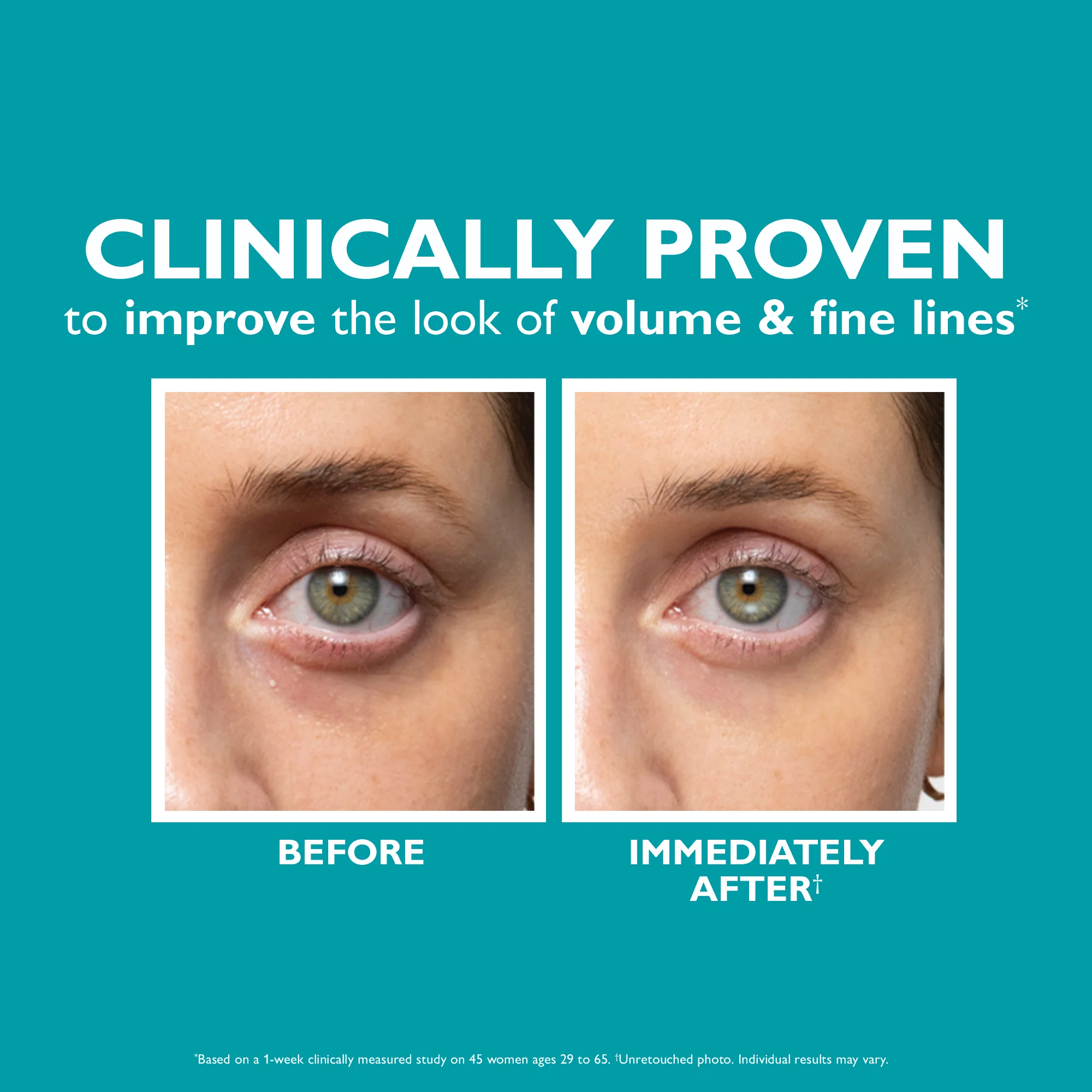 Peptide Skinjection™ Fill + Fix Under-Eye Cream - Image 5