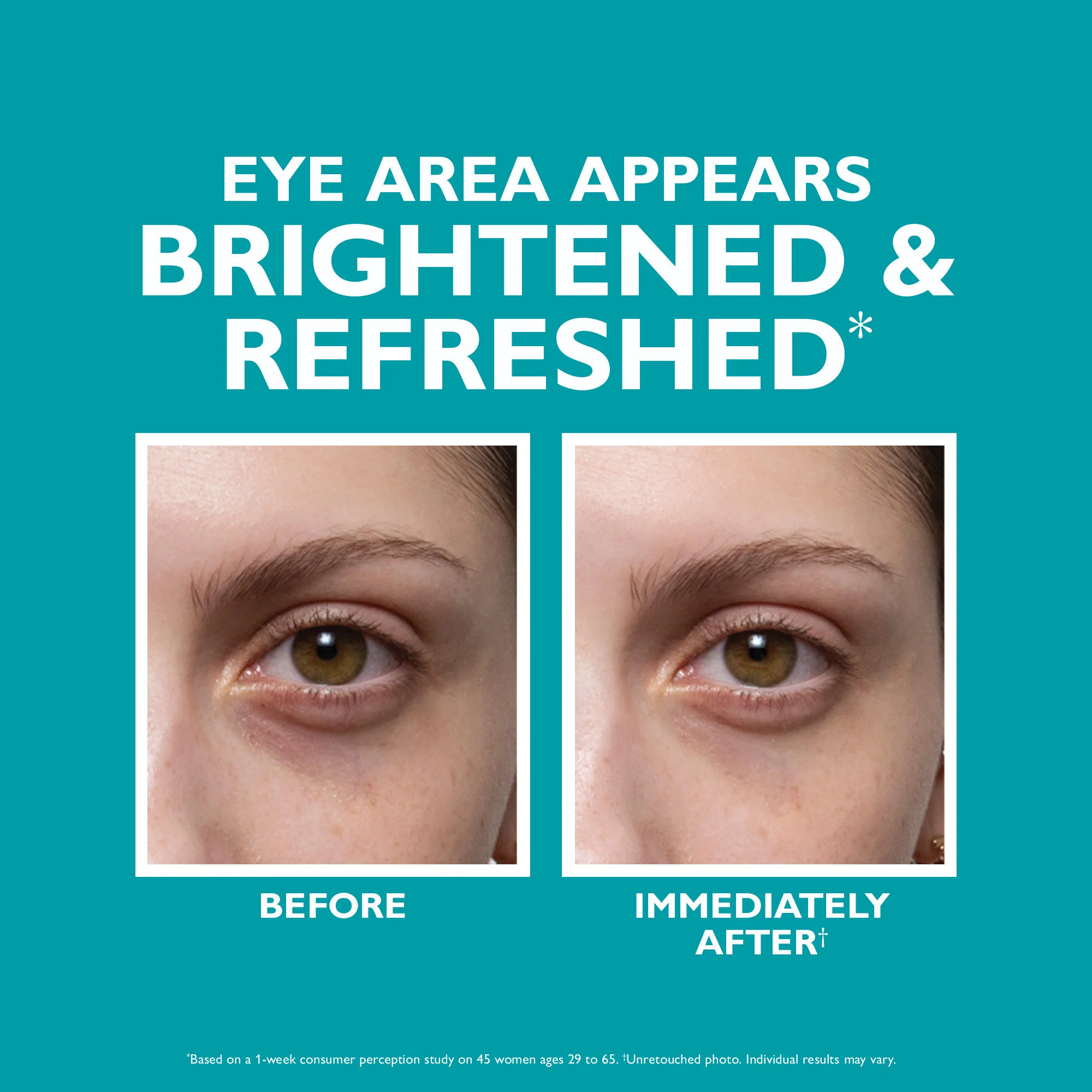 Peptide Skinjection™ Fill + Fix Under-Eye Cream - Image 7