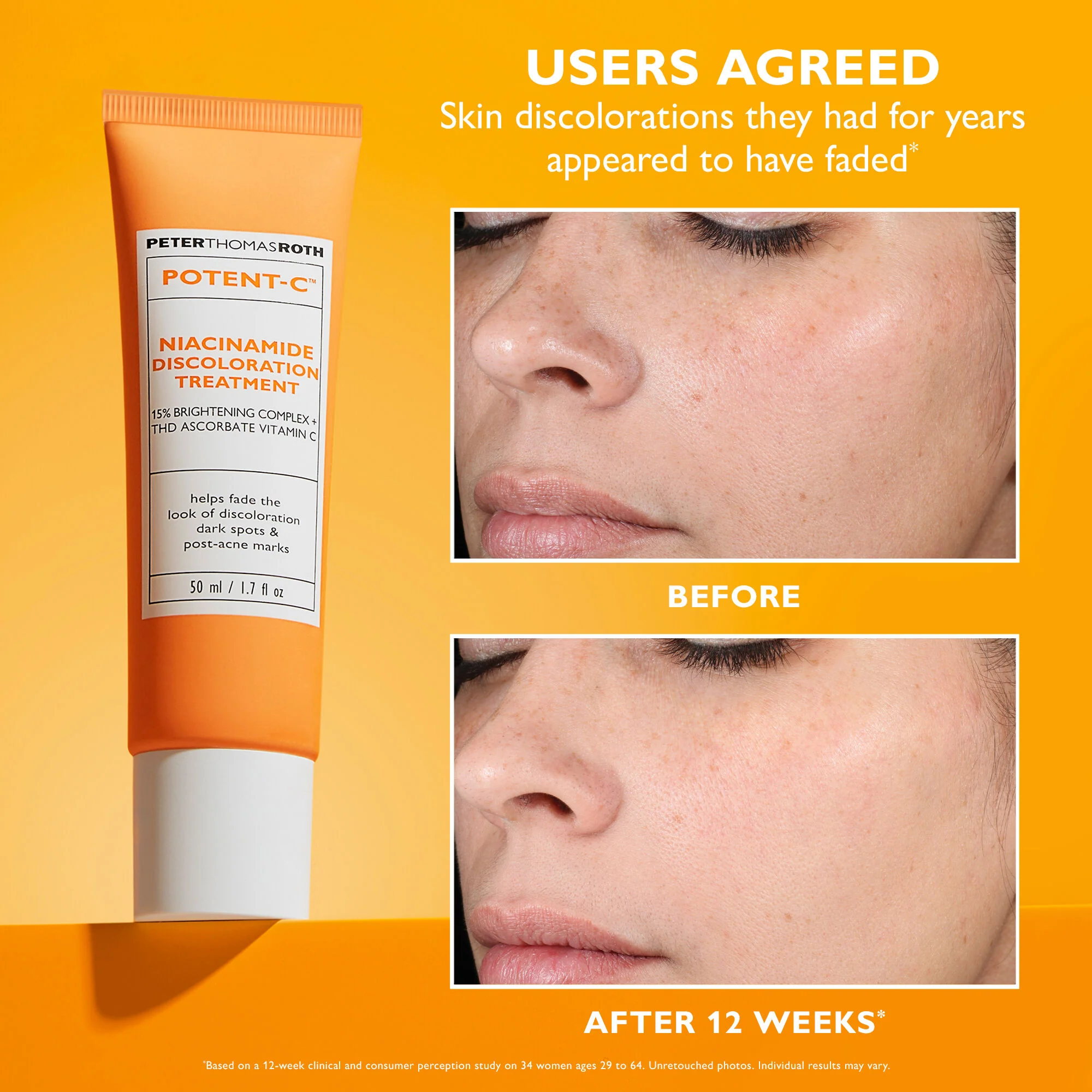Potent-C Niacinamide Discoloration Treatment | 50 ml/1.7 fl oz - Image 2