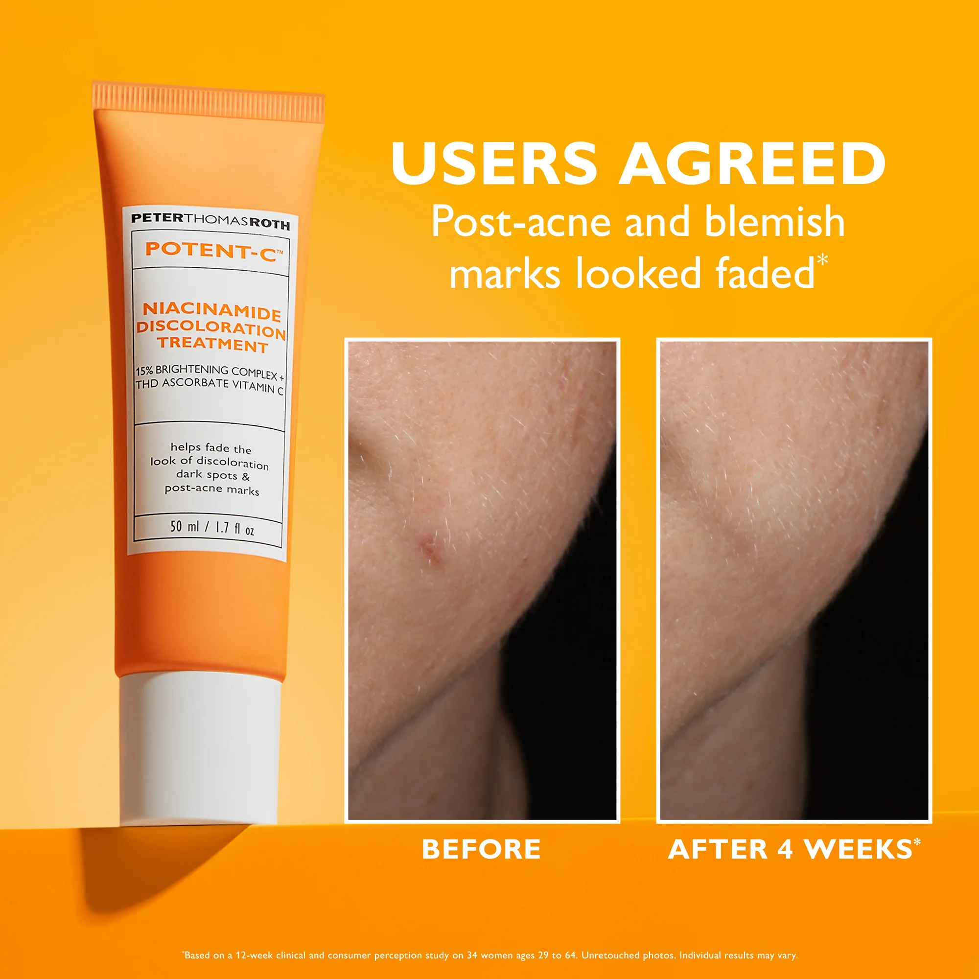 Potent-C Niacinamide Discoloration Treatment | 50 ml/1.7 fl oz - Image 5