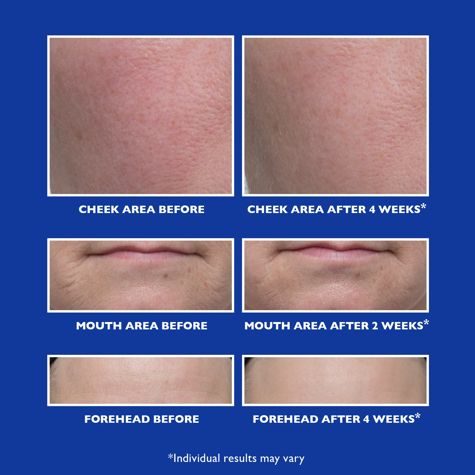 Retinol Fusion PM Night Serum - Super Size|2.0 fl oz - Image 3
