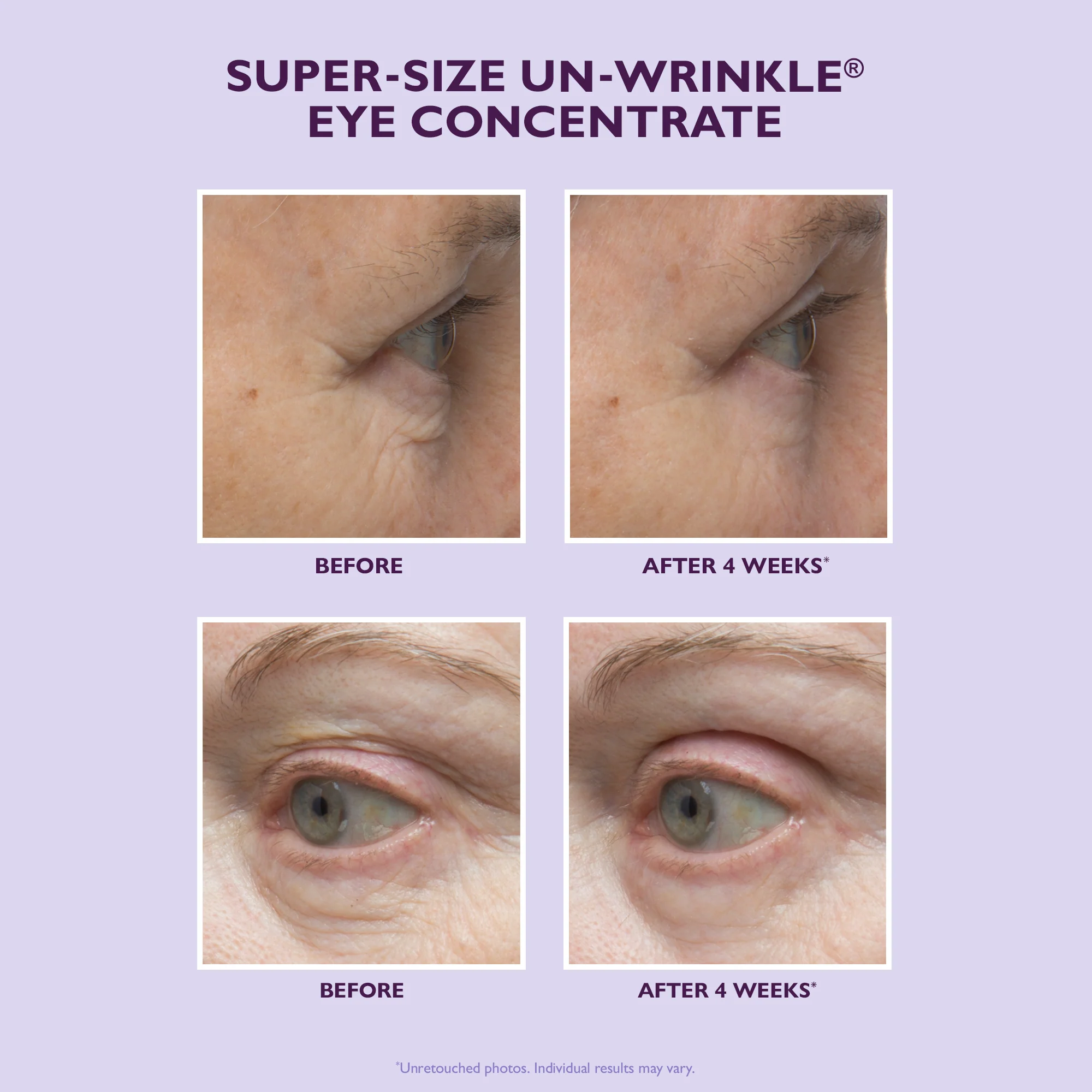 Super-Size Un-Wrinkle Eye Concentrate|30 ml / 1 oz - Image 2