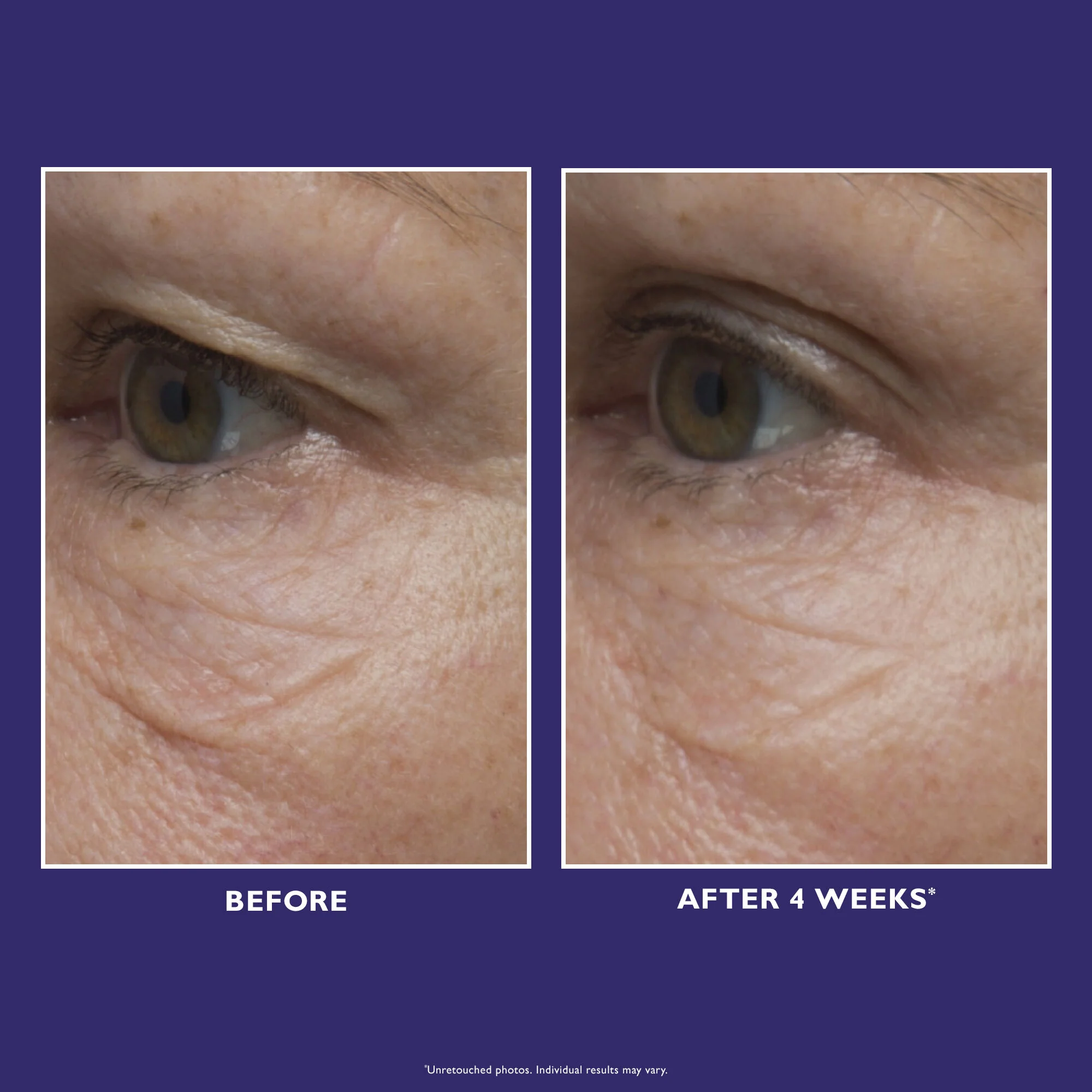Ultimate Solution 5 Multitasking Eye Cream|15 ml / 0.5 fl oz - Image 3